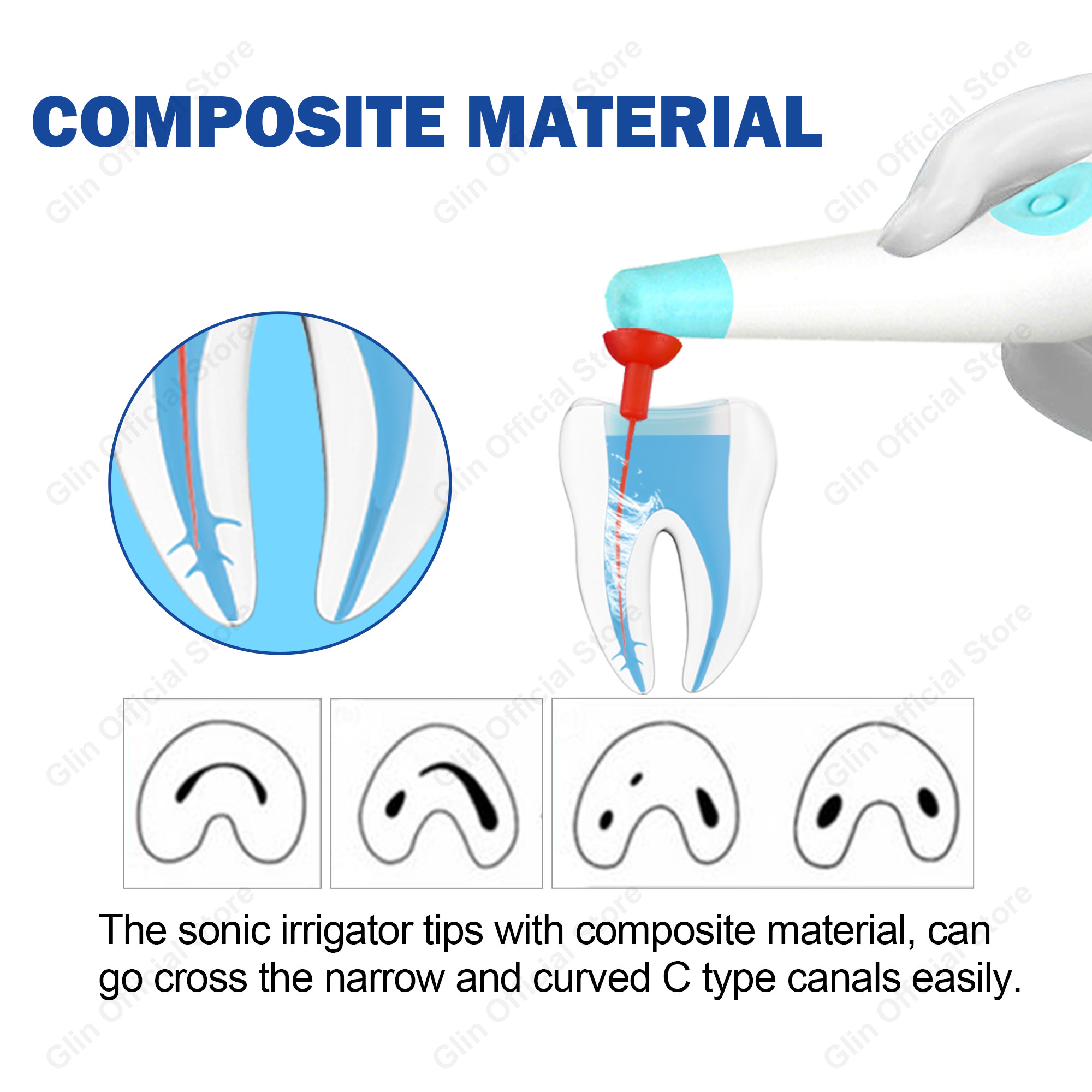 Glin 20pcs Tips Dental Sonic I - đánh giá và giá L Musical Instrument